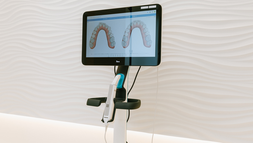 ②歯科用CT、iTero5Dを導入した新しい矯正治療を提供